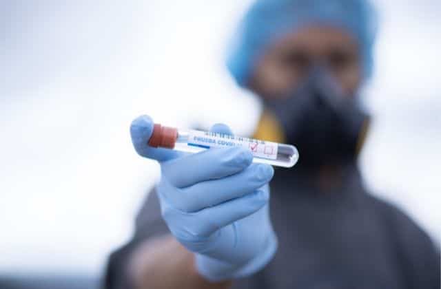 Covid-19: Brasil tem 10,2 mil novos casos e 97 mortes em 24 horas 3 coronavirus 1