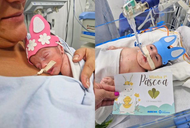 HM de Americana promove ação de Páscoa para recém-nascidos na UTI Neonatal 1 HM de Americana promove ação de Páscoa para recém-nascidos na UTI Neonatal