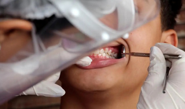 Mulheres vítimas de violência podem ter reconstrução dentária pelo SUS 1 Mulheres vítimas de violência podem ter reconstrução dentária pelo SUS