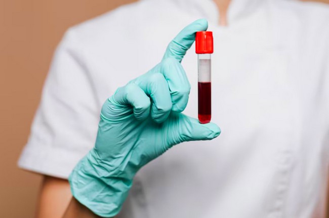 Santa Bárbara realiza campanha de doação de sangue em 8 de julho 1 Santa Bárbara realiza campanha de doação de sangue em 8 de julho
