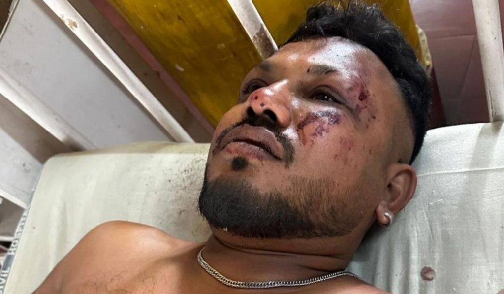 Uma pessoa sobrevive à queda de avião na Índia com 242 pessoa a bordo 1 sobrevivente-aviao-india