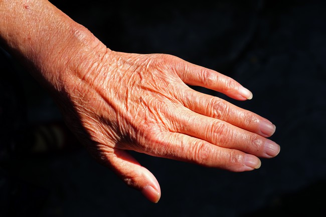 Idosa de 67 anos é espancada pelo marido em Santa Bárbara