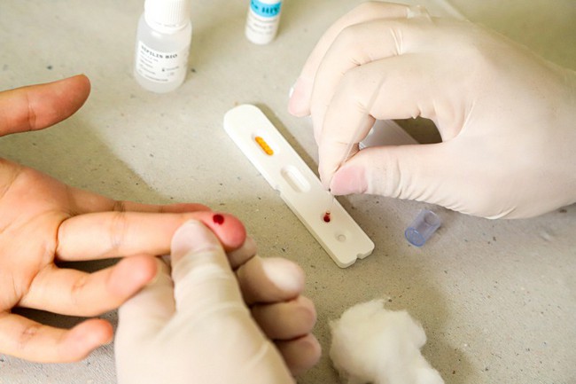 Testagem gratuita para hepatites é reforçada em Santa Bárbara
