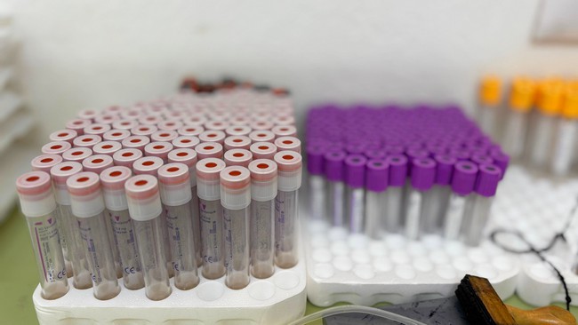 Banco de Sangue de Americana alerta para urgência de doações 2 Banco de Sangue de Americana alerta para urgência de doações