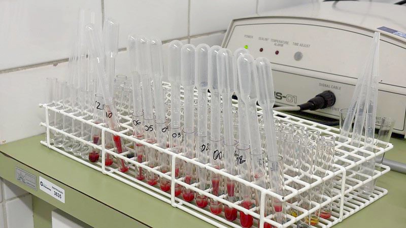 Banco de Sangue do HM precisa de todos os tipos sanguíneos