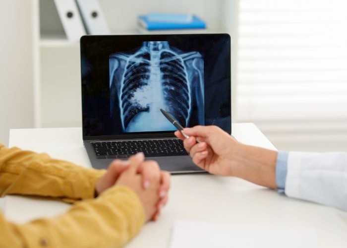 Americana se destaca no Estado pelo combate à tuberculose