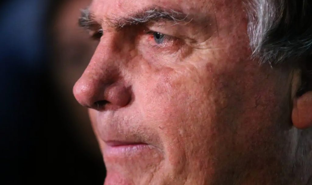Bolsonaro passa por nova cirurgia após crise de soluços