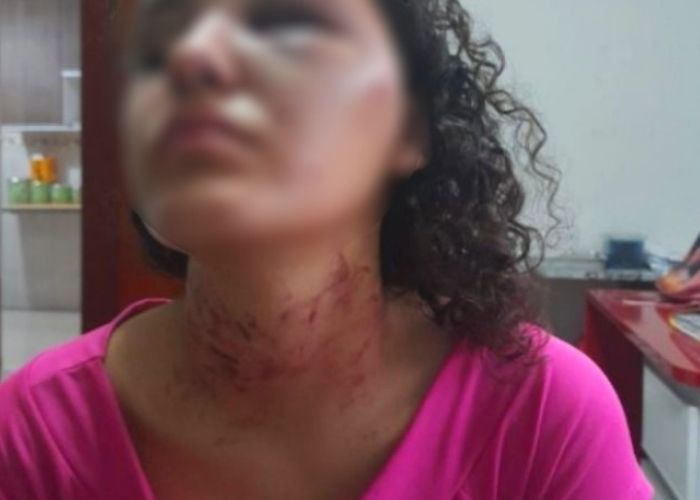 Jovem se finge de morta para escapar de estupro em Hortolândia