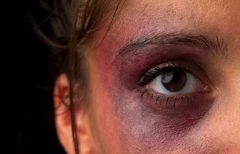 GCM escuta gritos durante patrulhamento e socorre vítima de agressão em S. Bárbara