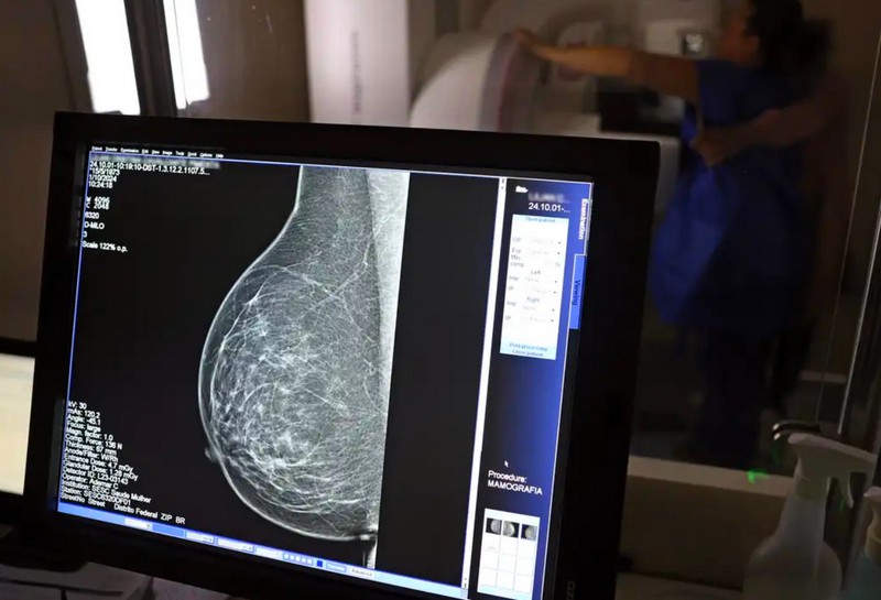 Nova Lei garante até três folgas para exames preventivos por ano