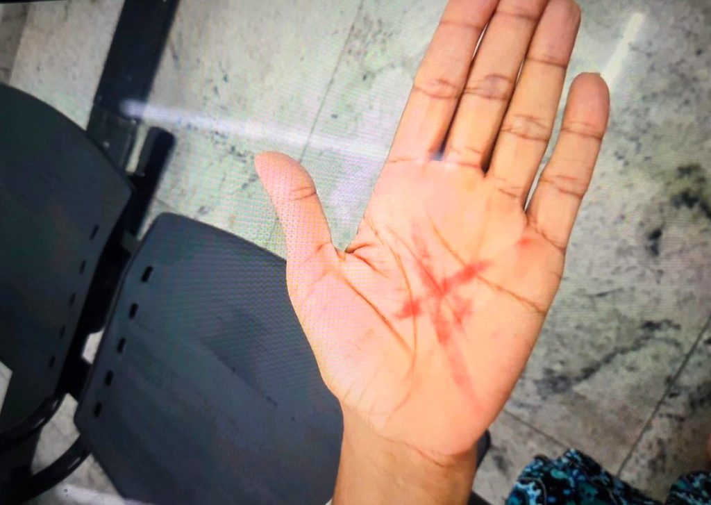 Sinal de socorro na mão leva à prisão por violência doméstica em Americana