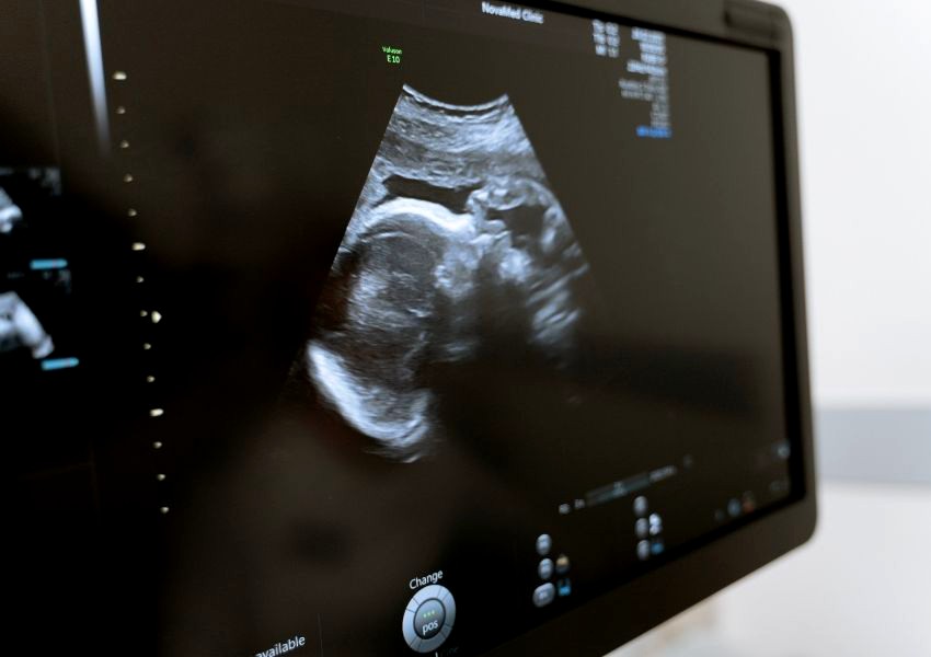 Nova Odessa inicia mutirão para realizar 8 mil exames de ultrassom