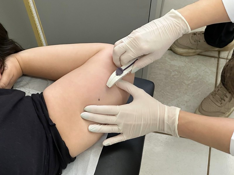 Americana oferece 750 implantes contraceptivos gratuitos em mutirão no dia 24