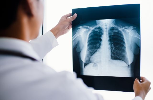 cancer-pulmao